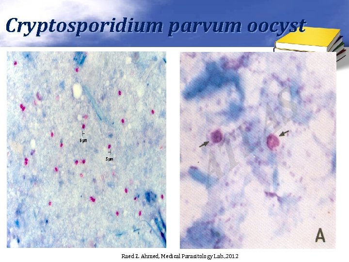 Cryptosporidium parvum oocyst Raed Z. Ahmed, Medical Parasitology Lab. , 2012 