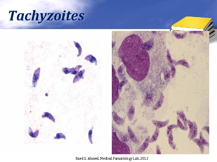 Tachyzoites Raed Z. Ahmed, Medical Parasitology Lab. , 2012 