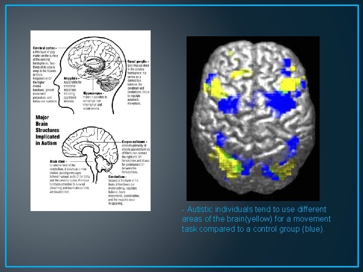 - Autistic individuals tend to use different areas of the brain(yellow) for a movement