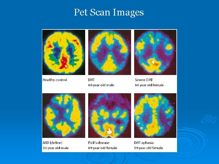 Pet Scan Images 