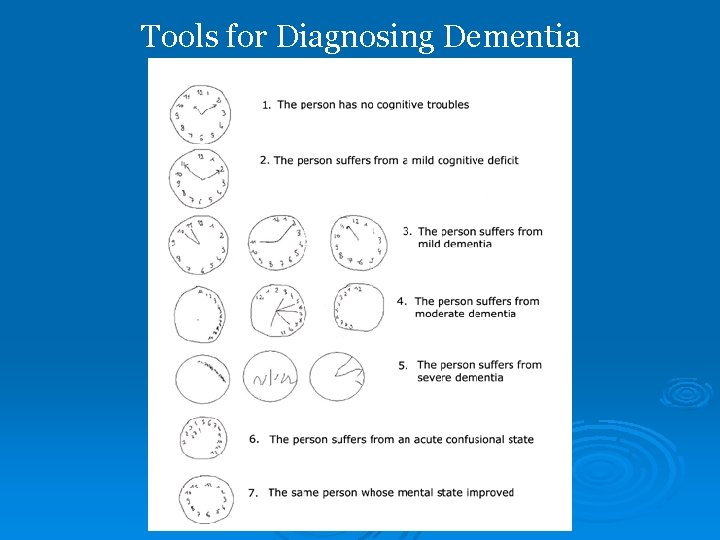 Tools for Diagnosing Dementia 