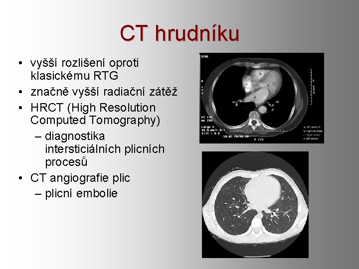 CT hrudníku • vyšší rozlišení oproti klasickému RTG • značně vyšší radiační zátěž •