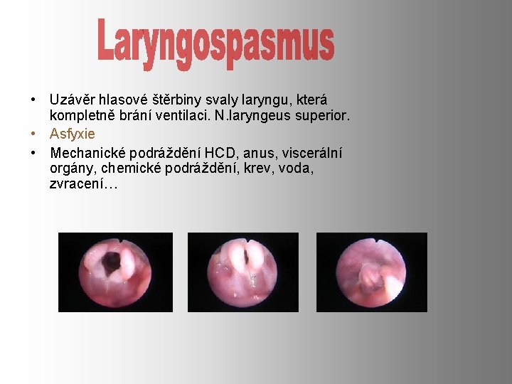  • Uzávěr hlasové štěrbiny svaly laryngu, která kompletně brání ventilaci. N. laryngeus superior.
