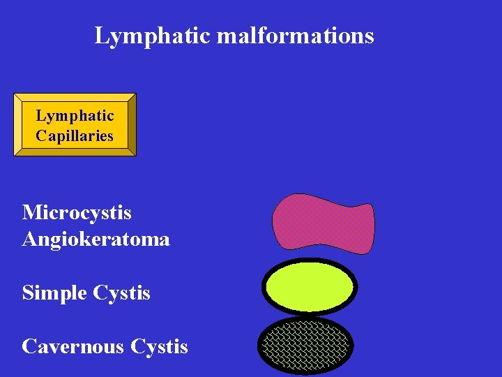Lymphatic malformations Lymphatic Capillaries Microcystis Angiokeratoma Simple Cystis Cavernous Cystis Lymphatic malformations Lymphatic Capillaries Microcystis Angiokeratoma Simple Cystis Cavernous Cystis