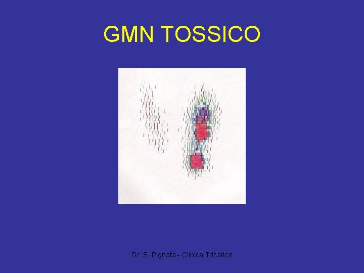 GMN TOSSICO Dr. S. Pignata - Clinica Tricarico 