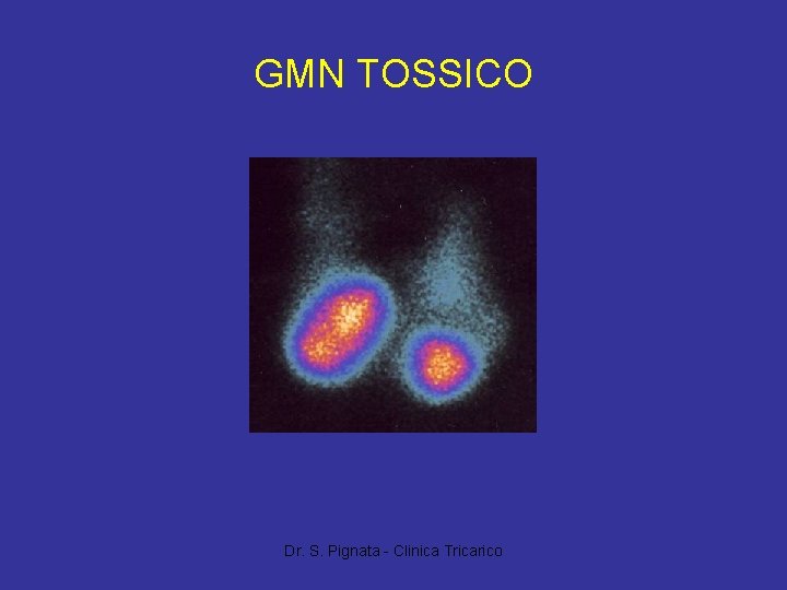 GMN TOSSICO Dr. S. Pignata - Clinica Tricarico 