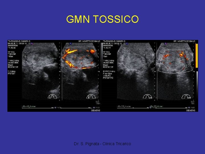 GMN TOSSICO Dr. S. Pignata - Clinica Tricarico 