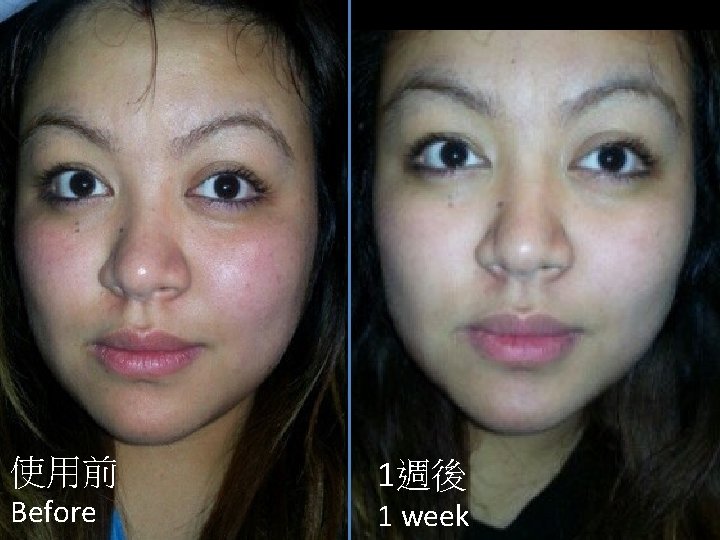 使用前 Before 1週後 1 week 