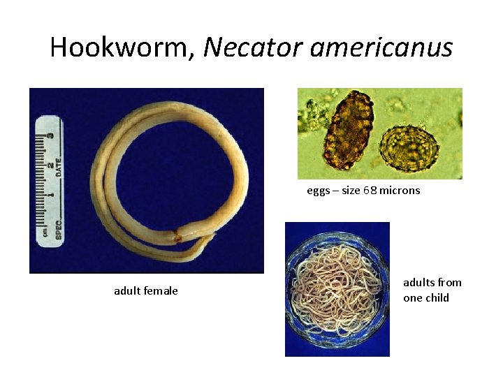 Hookworm, Necator americanus eggs – size 68 microns adult female adults from one child