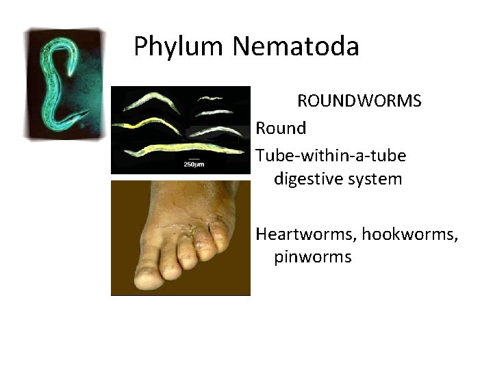 Phylum Nematoda ROUNDWORMS Round Tube-within-a-tube digestive system Heartworms, hookworms, pinworms 