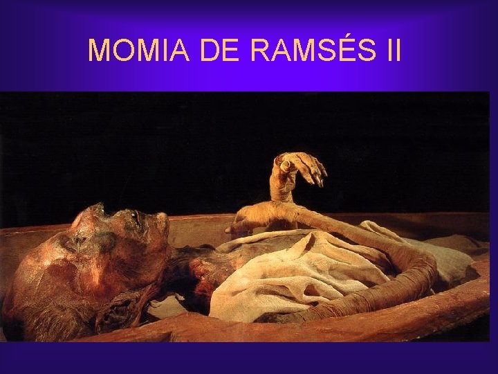 MOMIA DE RAMSÉS II 