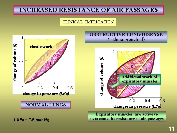 INCREASED RESISTANCE OF AIR PASSAGES CLINICAL IMPLICATION OBSTRUCTIVE LUNG DISEASE (asthma bronchial) elastic work