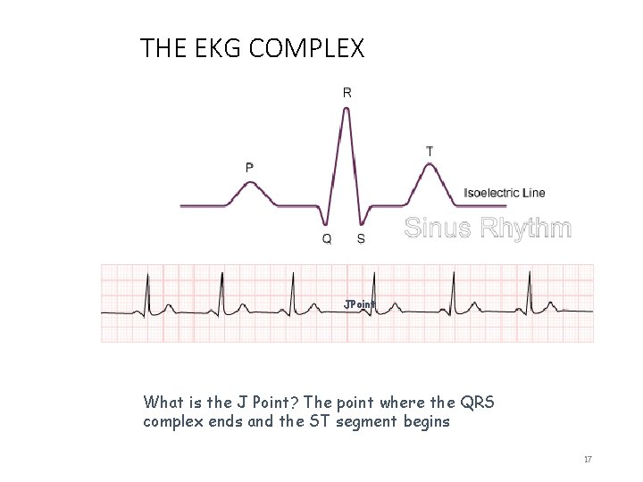 THE EKG COMPLEX JPoint What is the J Point? The point where the QRS