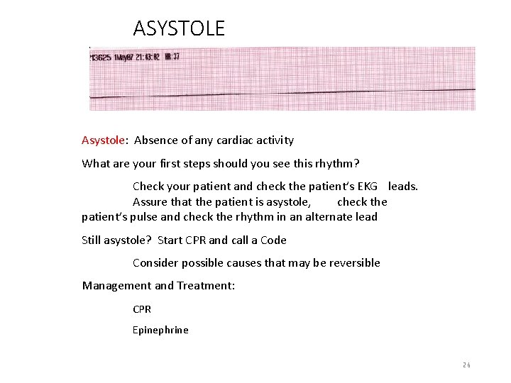 ASYSTOLE Asystole: Absence of any cardiac activity What are your first steps should you