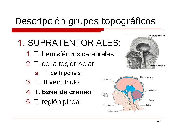 Descripción grupos topográficos 1. SUPRATENTORIALES: 1. T. hemisféricos cerebrales 2. T. de la región