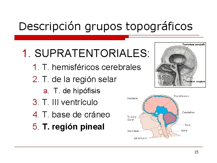 Descripción grupos topográficos 1. SUPRATENTORIALES: 1. T. hemisféricos cerebrales 2. T. de la región