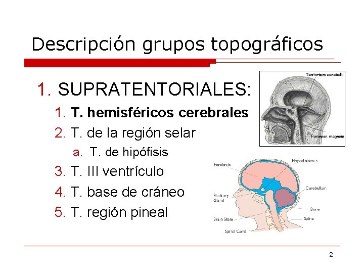 Descripción grupos topográficos 1. SUPRATENTORIALES: 1. T. hemisféricos cerebrales 2. T. de la región