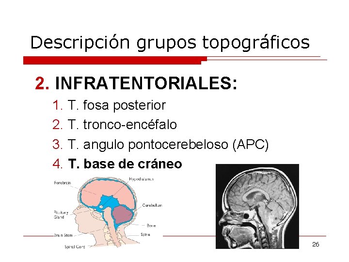 Descripción grupos topográficos 2. INFRATENTORIALES: 1. T. fosa posterior 2. T. tronco-encéfalo 3. T.