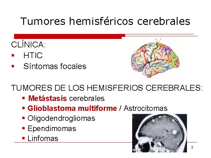 Tumores hemisféricos cerebrales CLÍNICA: § HTIC § Síntomas focales TUMORES DE LOS HEMISFERIOS CEREBRALES: