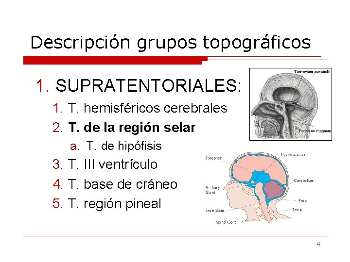 Descripción grupos topográficos 1. SUPRATENTORIALES: 1. T. hemisféricos cerebrales 2. T. de la región