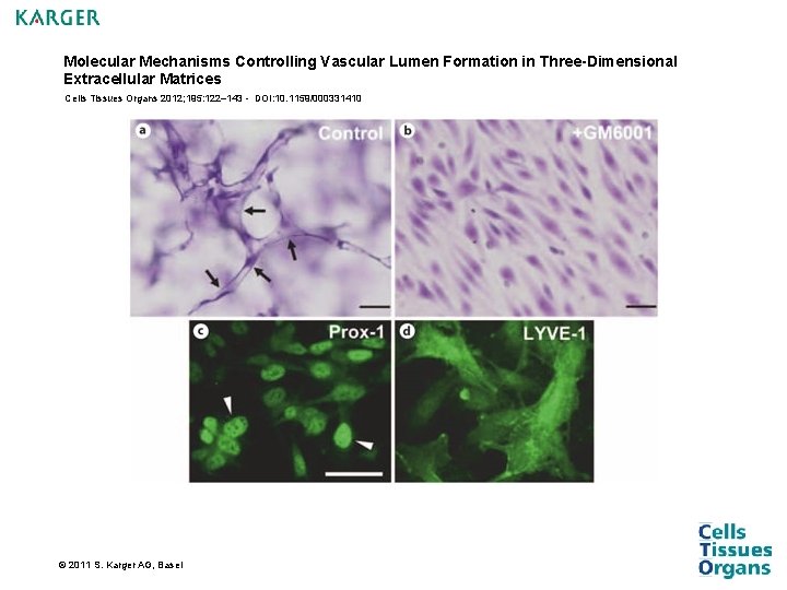 Molecular Mechanisms Controlling Vascular Lumen Formation in Three-Dimensional Extracellular Matrices Cells Tissues Organs 2012; Molecular Mechanisms Controlling Vascular Lumen Formation in Three-Dimensional Extracellular Matrices Cells Tissues Organs 2012;
