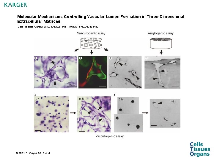 Molecular Mechanisms Controlling Vascular Lumen Formation in Three-Dimensional Extracellular Matrices Cells Tissues Organs 2012; Molecular Mechanisms Controlling Vascular Lumen Formation in Three-Dimensional Extracellular Matrices Cells Tissues Organs 2012;
