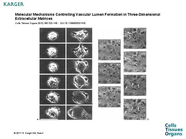 Molecular Mechanisms Controlling Vascular Lumen Formation in Three-Dimensional Extracellular Matrices Cells Tissues Organs 2012; Molecular Mechanisms Controlling Vascular Lumen Formation in Three-Dimensional Extracellular Matrices Cells Tissues Organs 2012;