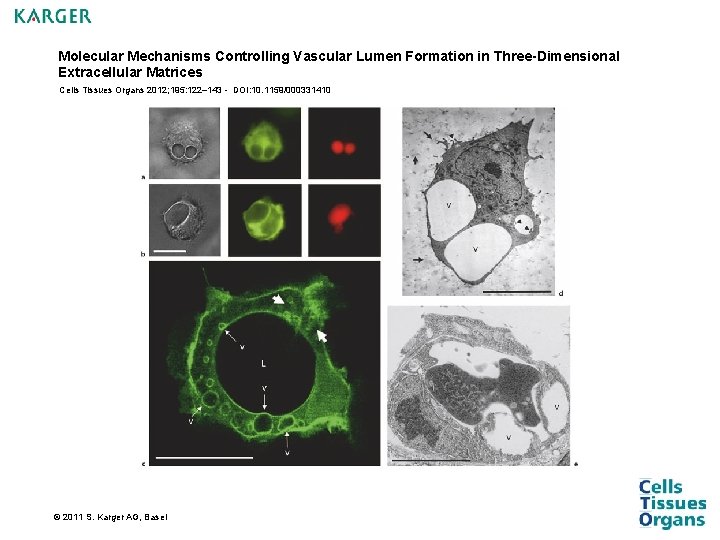 Molecular Mechanisms Controlling Vascular Lumen Formation in Three-Dimensional Extracellular Matrices Cells Tissues Organs 2012; Molecular Mechanisms Controlling Vascular Lumen Formation in Three-Dimensional Extracellular Matrices Cells Tissues Organs 2012;