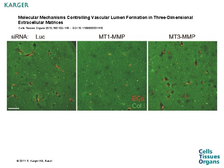 Molecular Mechanisms Controlling Vascular Lumen Formation in Three-Dimensional Extracellular Matrices Cells Tissues Organs 2012; Molecular Mechanisms Controlling Vascular Lumen Formation in Three-Dimensional Extracellular Matrices Cells Tissues Organs 2012;