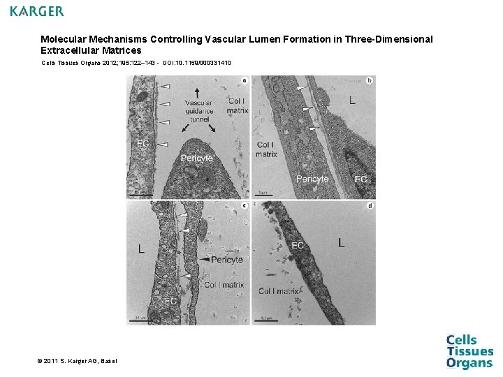 Molecular Mechanisms Controlling Vascular Lumen Formation in Three-Dimensional Extracellular Matrices Cells Tissues Organs 2012; Molecular Mechanisms Controlling Vascular Lumen Formation in Three-Dimensional Extracellular Matrices Cells Tissues Organs 2012;