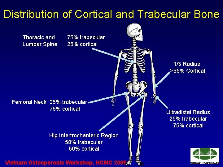 Distribution of Cortical and Trabecular Bone Thoracic and Lumbar Spine 75% trabecular 25% cortical