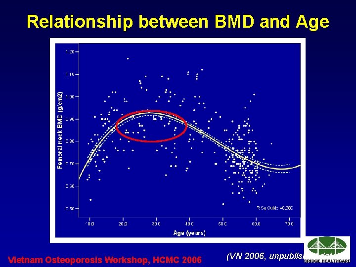 Relationship between BMD and Age Vietnam Osteoporosis Workshop, HCMC 2006 (VN 2006, unpublished data) Relationship between BMD and Age Vietnam Osteoporosis Workshop, HCMC 2006 (VN 2006, unpublished data)