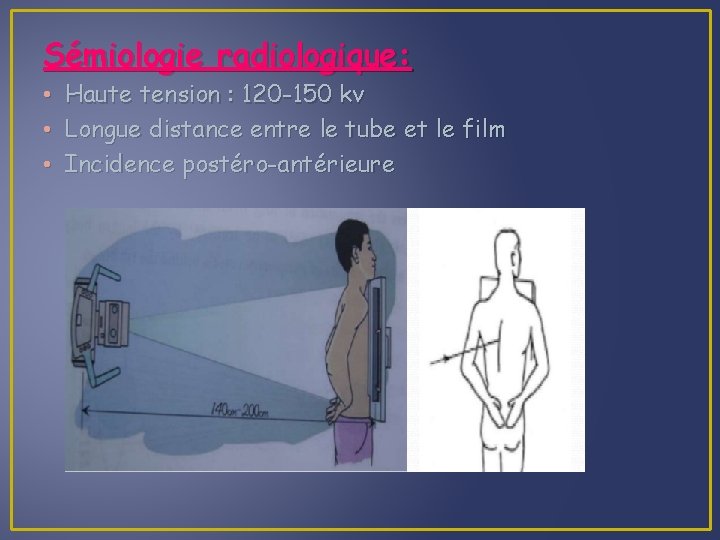 Sémiologie radiologique: • • • Haute tension : 120 -150 kv Longue distance entre