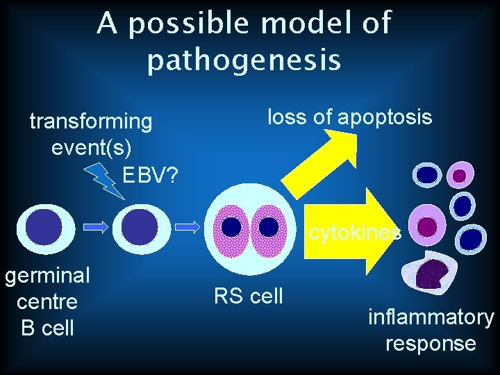 A possible model of pathogenesis transforming event(s) EBV? loss of apoptosis cytokines germinal centre