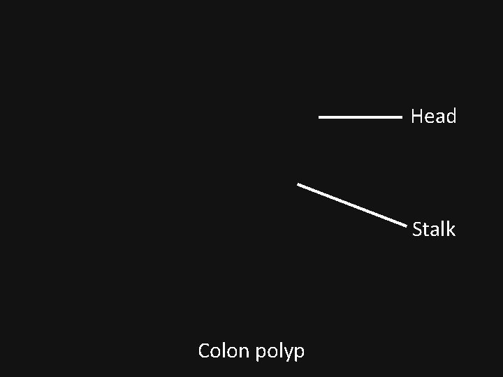 Head Stalk Colon polyp 