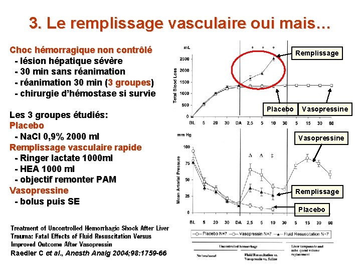 3. Le remplissage vasculaire oui mais… Choc hémorragique non contrôlé - lésion hépatique sévère