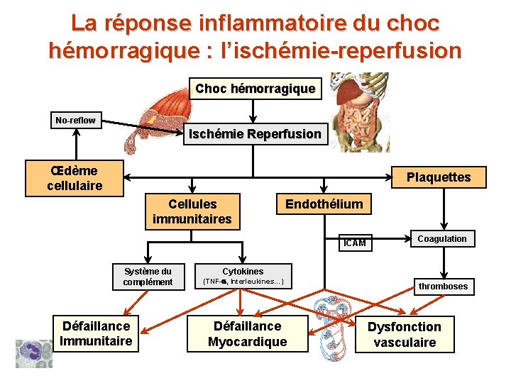 La réponse inflammatoire du choc hémorragique : l’ischémie-reperfusion Choc hémorragique No-reflow Ischémie Reperfusion Œdème