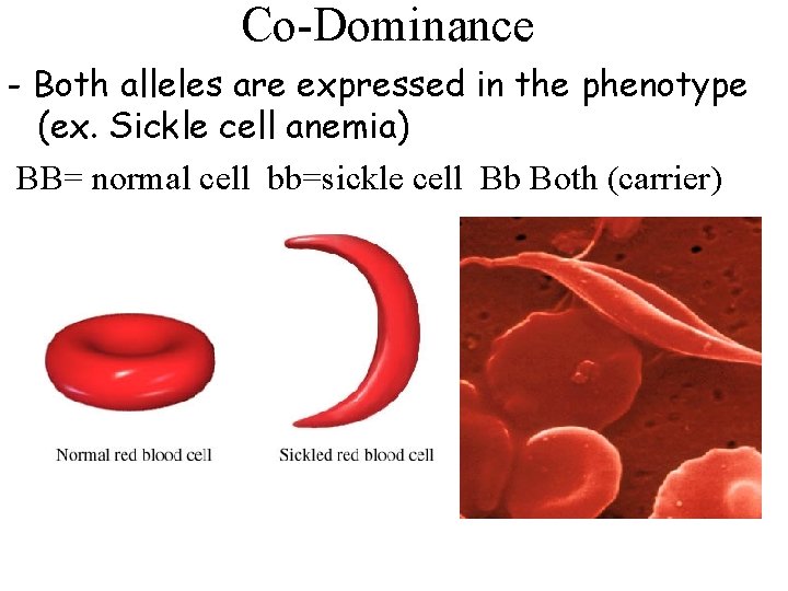 Co-Dominance - Both alleles are expressed in the phenotype (ex. Sickle cell anemia) BB=