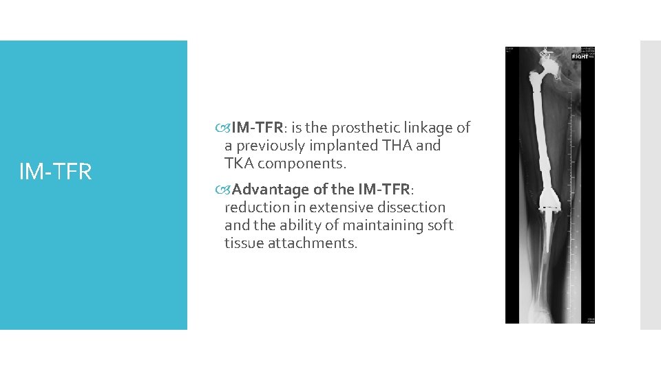 IM-TFR IM-TFR: is the prosthetic linkage of a previously implanted THA and TKA components.