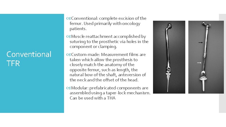  Conventional: complete excision of the femur. Used primarily with oncology patients. Conventional TFR