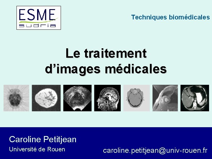 Techniques biomédicales Le traitement d’images médicales Caroline Petitjean Université de Rouen caroline. petitjean@univ-rouen. fr