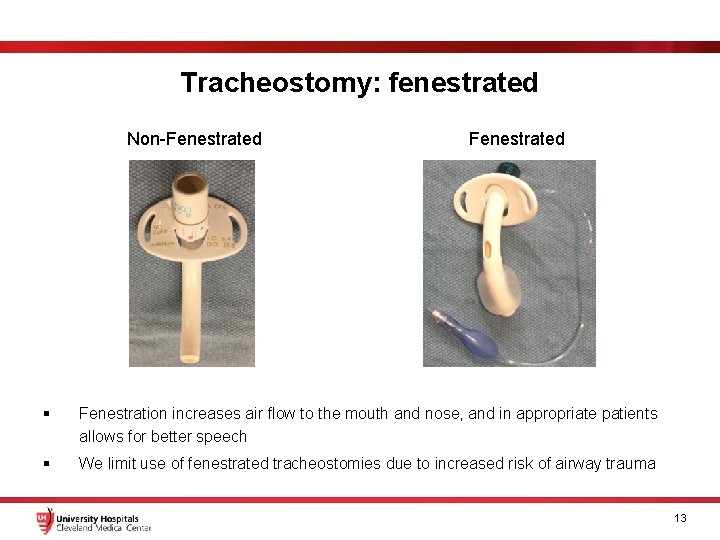 Tracheostomy: fenestrated Non-Fenestrated § Fenestration increases air flow to the mouth and nose, and