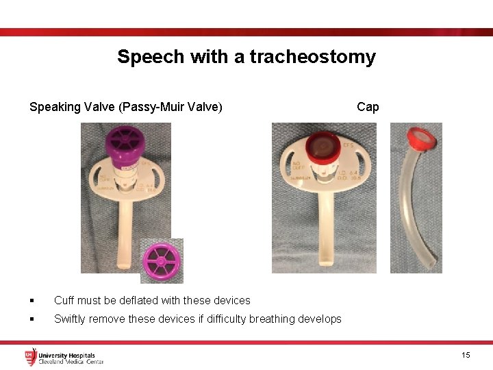 Speech with a tracheostomy Speaking Valve (Passy-Muir Valve) § Cuff must be deflated with