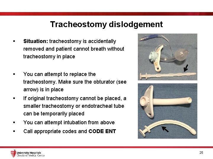 Tracheostomy dislodgement § Situation: tracheostomy is accidentally removed and patient cannot breath without tracheostomy