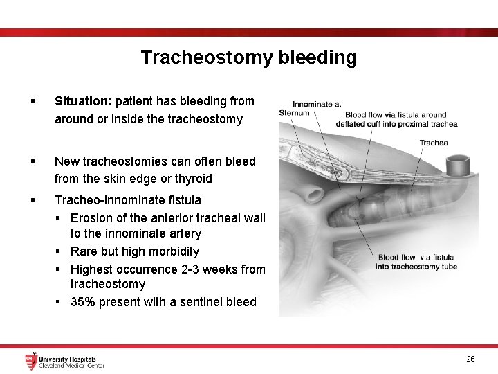 Tracheostomy bleeding § Situation: patient has bleeding from around or inside the tracheostomy §