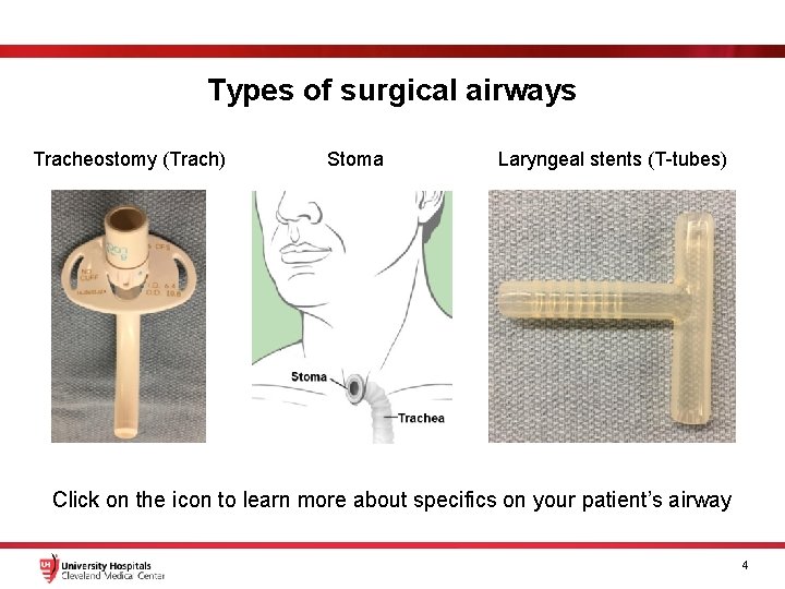 Types of surgical airways Tracheostomy (Trach) Stoma Laryngeal stents (T-tubes) Click on the icon