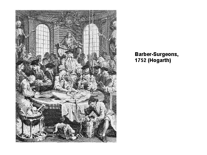 Barber-Surgeons, 1752 (Hogarth) 