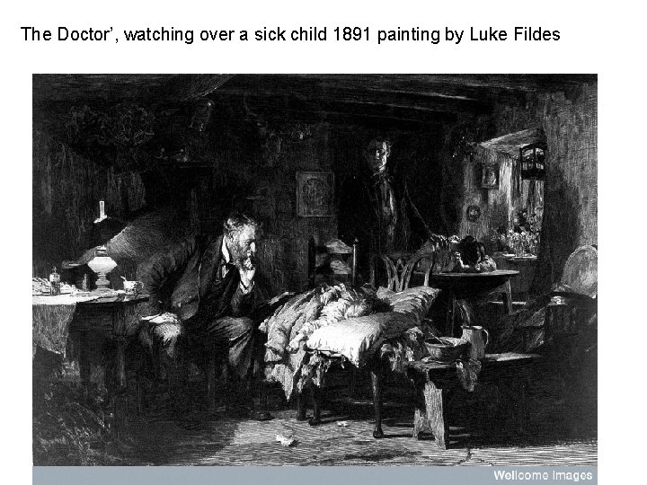 The Doctor’, watching over a sick child 1891 painting by Luke Fildes 