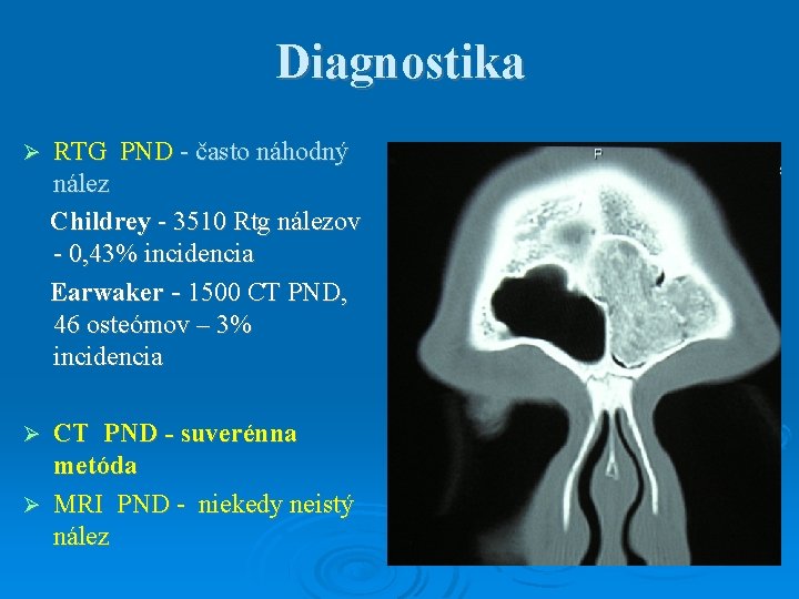 Diagnostika RTG PND - často náhodný nález Childrey - 3510 Rtg nálezov - 0,