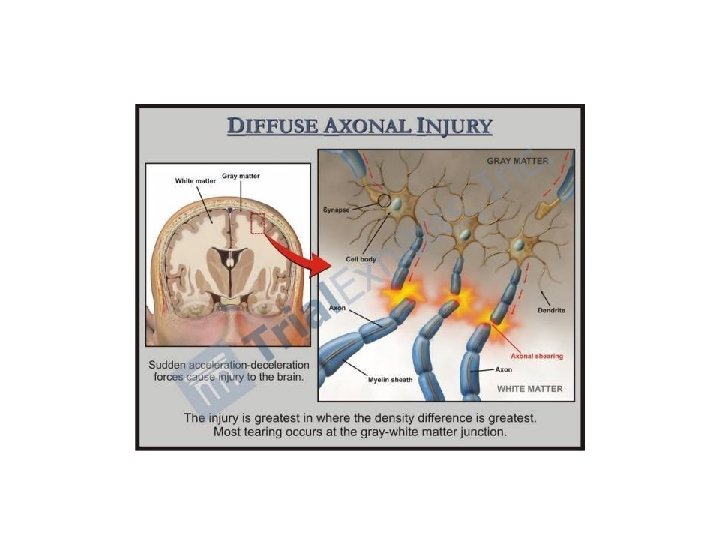CENTRAL NERVOUS SYSTEM TRAUMA and Subarachnoid Hemorrhage By